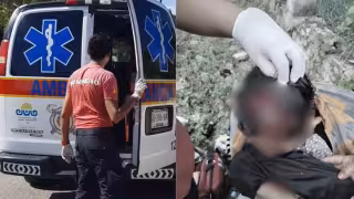 Motociclista sufre desprendimiento de cuero cabelludo tras derrapar en Chetumal