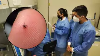 El tifus murino se propaga través de pulgas