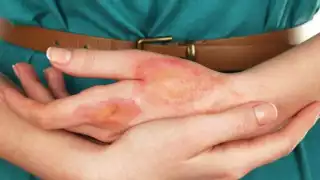 A nivel nacional aumentó 23.9% las incidencias