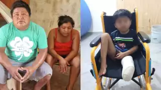 Niño de 5 años  podría perder una pierna luego de un trágico accidente en Kimbilá; familia suplica por apoyo