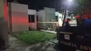 Abuelita de Ciudad Caucel es atacada por dos pitbulls; recibió 27 mordidas