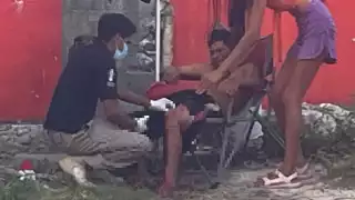 El hombre recibió un impacto de bala en la pierna