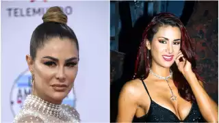 Ninel Conde revela que se hará otro tratamiento en la cara