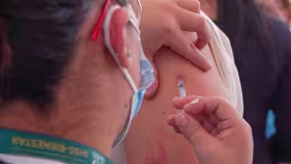 Sarampión en México: estos son los primeros síntomas y por qué la vacunación está frenando el brote