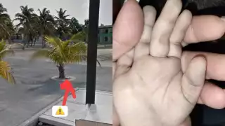 El menor fue atendido por un médico en Progreso, donde se encuentra fuera de peligro