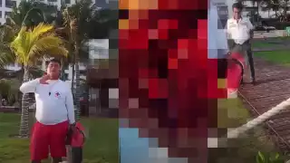 El golpe fue tan fuerte que le tiro los dientes de enfrente