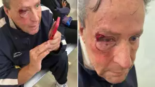 ¿Alfredo Adame puede perder el ojo?