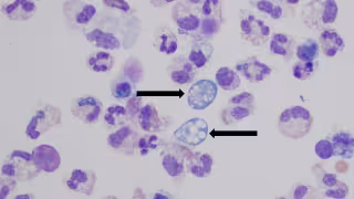 ¿Qué es la ameba Naegleria y por qué son un peligro en los lagos de Mérida?