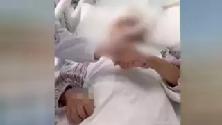 Maestra fractura cráneo de una alumna luego de golpearla con una regla de metal