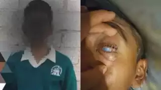 El menor perdió la vista del ojo izquierdo y un 90 por ciento del ojo derecho