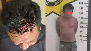 El hombre resultó herido en la cabeza con el machete