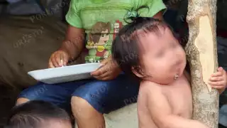 Preocupa alza de desnutrición infantil en Campeche