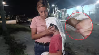 ‘Un animal no puede ser demandado’: madre acusa omisión de Fiscalía en Escárcega tras ataque de perro