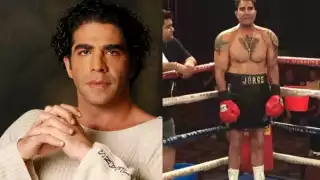 Tal parece que al exdiputado por Nueva Alianza le agarró el gusto por las operaciones estéticas,