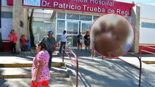 Adulto mayor diabético podría perder el pie por presunta negligencia en el ISSSTE Campeche