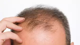 Hoy ser calvo es un signo de belleza. Foto: Especial