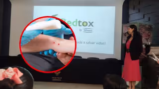 Casos de mordeduras de serpiente aumentan en Yucatán; expertos piden no automedicarse