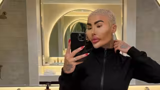 Muere el influencer Jordan James Parke, luego de someterse a un procedimiento estético
