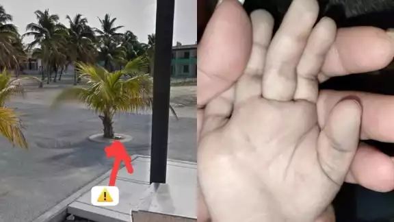 El menor fue atendido por un médico en Progreso, donde se encuentra fuera de peligro El menor fue atendido por un médico en Progreso, donde se encuentra fuera de peligro