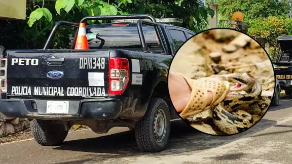 La serpiente picó a la niña en el pie derecho La serpiente picó a la niña en el pie derecho