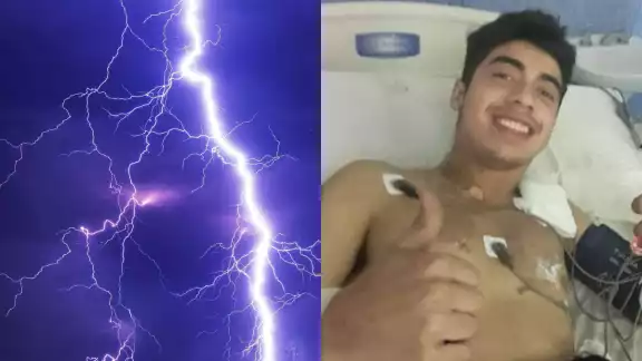 El joven sólo presentó quemaduras en el cuerpo tras el impacto del rayo El joven sólo presentó quemaduras en el cuerpo tras el impacto del rayo