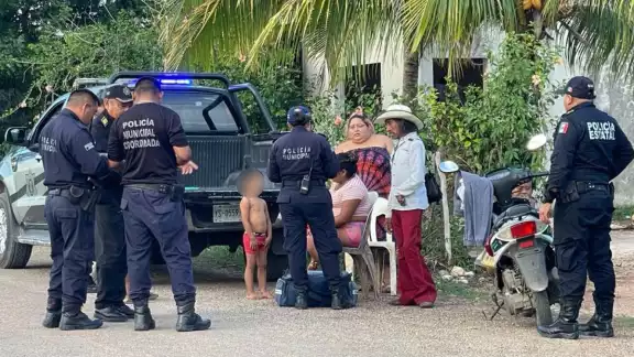 La niña recibió la descarga del cable de una bocina La niña recibió la descarga del cable de una bocina