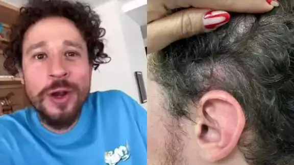 Luisito Comunica ólo se llevó un golpe y un gran susto Luisito Comunica ólo se llevó un golpe y un gran susto