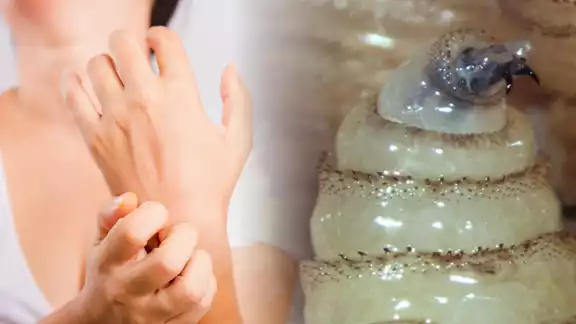 Adultos mayores y personas con heridas abiertas, los más vulnerables ante el gusano barrenador en Campeche