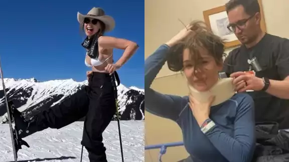 Camila Sodi ya registra una mejoría en sus heridas