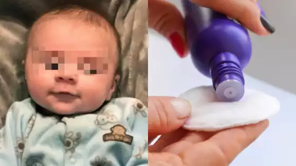 La bebé había consumido baterías, tornillos y acetona proporcionado por la novia de su papá