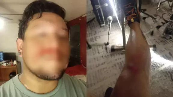 El hombre presentó lesiones leves tras ser atacado por los sujetos El hombre presentó lesiones leves tras ser atacado por los sujetos