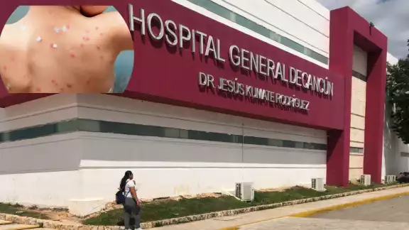 La Secretaría de Salud de Quintana Roo y el IMSS descartaron emitir alguna alerta; más del 60 por ciento de los infectados se encuentran en la zona Norte