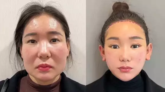 Así son las cirugías plásticas del doctor Kim Así son las cirugías plásticas del doctor Kim