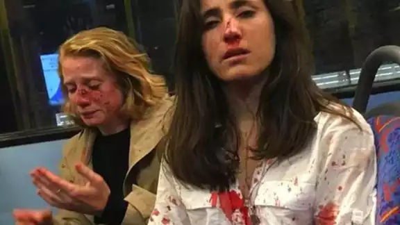 En redes sociales circula un video donde una joven uruguaya, aspirante a médica, se muestra con el rostro cubierto de sangre junto con la estadounidense Christine Hannigan En redes sociales circula un video donde una joven uruguaya, aspirante a médica, se muestra con el rostro cubierto de sangre junto con la estadounidense Christine Hannigan