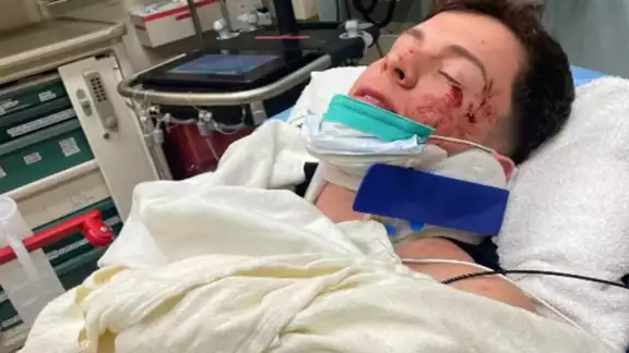 El cantante ya fue dado de alta y se recupera satisfactoriamente