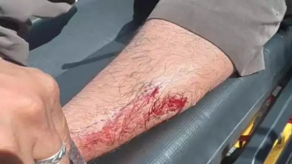 Lo subieron a una ambulancia de traslado del municipio para ser trasladado al Hospital General Agustín O’Horán de Mérida Lo subieron a una ambulancia de traslado del municipio para ser trasladado al Hospital General Agustín O’Horán de Mérida