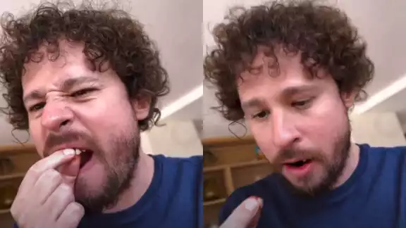 Luisito Comunica no ha dado a conocer la razón por la que se le cayeron dos dientes