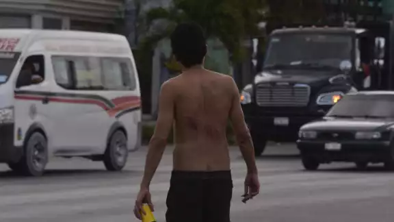 El hombre tenía algunas heridas, de lo que parece un machete en la espalda El hombre tenía algunas heridas, de lo que parece un machete en la espalda
