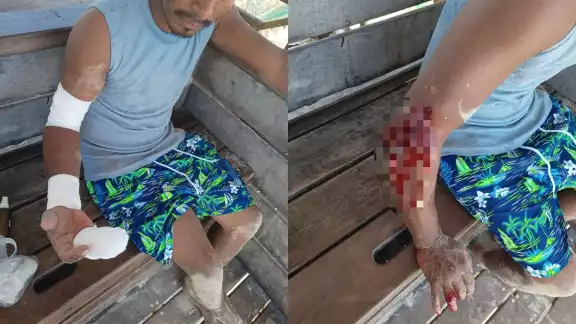 El dueño del perro aseguró hacerse cargo, pero también agredió a la víctima y huyó El dueño del perro aseguró hacerse cargo, pero también agredió a la víctima y huyó