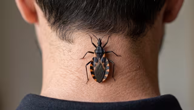La enfermedad de chagas se transmite mediante un insecto conocido como pic