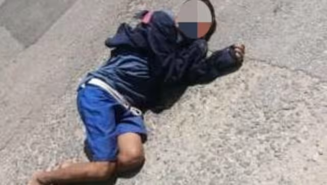 Después de calmarle la hemorragia lo trasladaron al Hospital General Agustín O’Horán