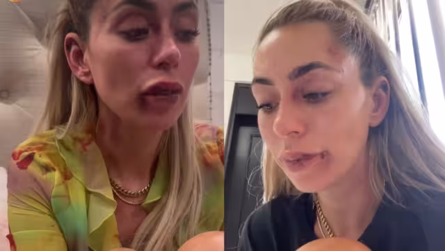 Policías de Querétaro agreden a conductora de Tv