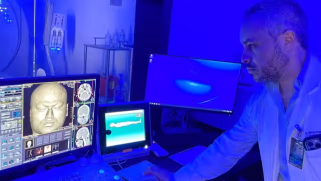 El nuevo equipo de tomografía llegó al hospital IMSS Juárez de Mérida