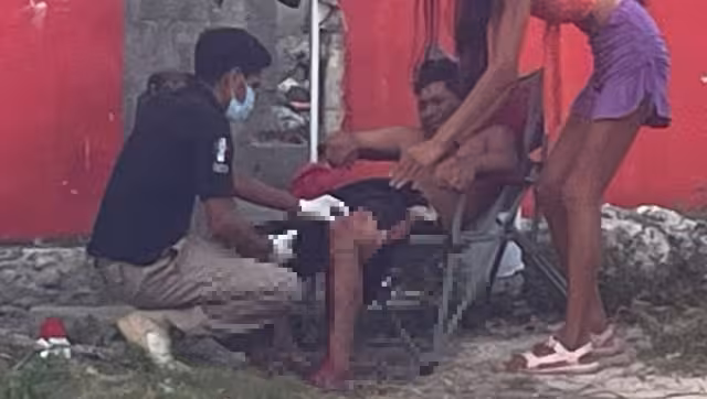 El hombre recibió un impacto de bala en la pierna