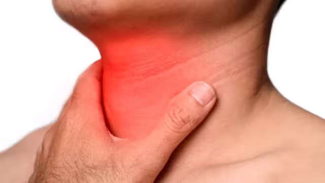 La faringitis suele causar diversas molestias por hasta 10 días