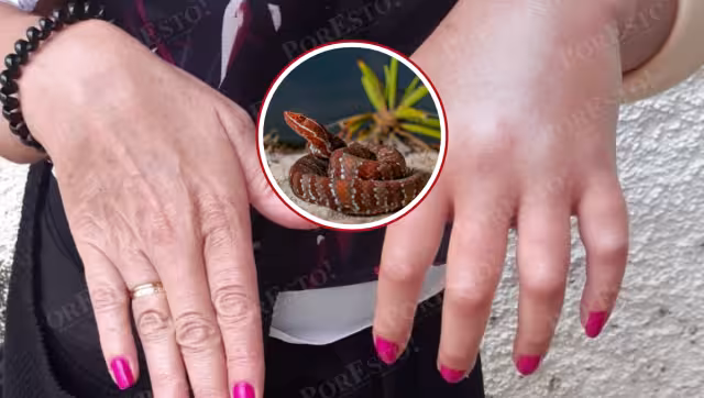 Antivenenos de Birmex y Silanes salvan vidas en Campeche