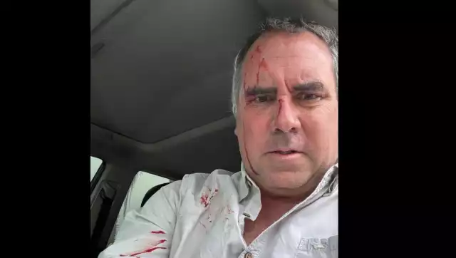 El vehículo recibió tres impactos de bala, aunque ninguno alcanzó directamente al precandidato, Rafael  Belaúnde