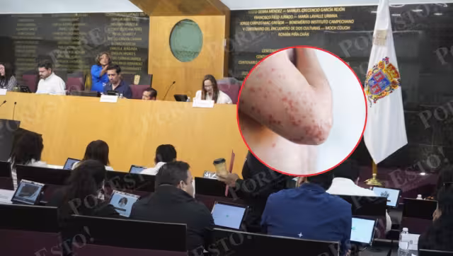 Piden informe detallado sobre sarampión y acciones de vacunación en Campeche