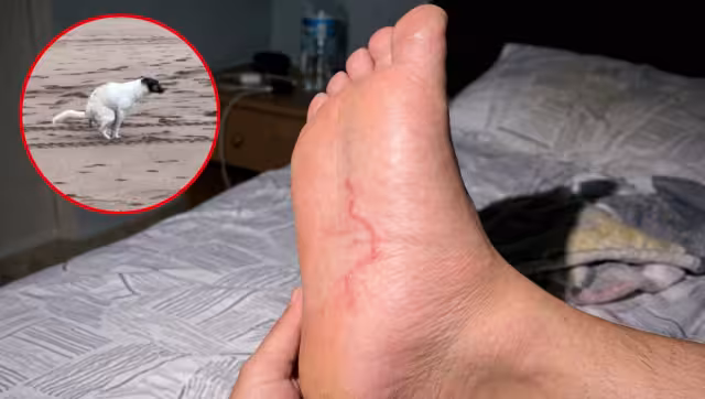 Es importante acudir al médico para confirmar el diagnóstico