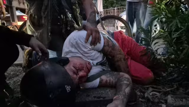 Motociclista resulta gravemente herido tras fuerte accidente en la colonia Salitral.